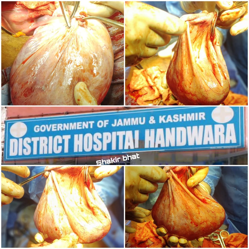 District Hospital Handwara Once Again In News For It’s Best Ever Performance.